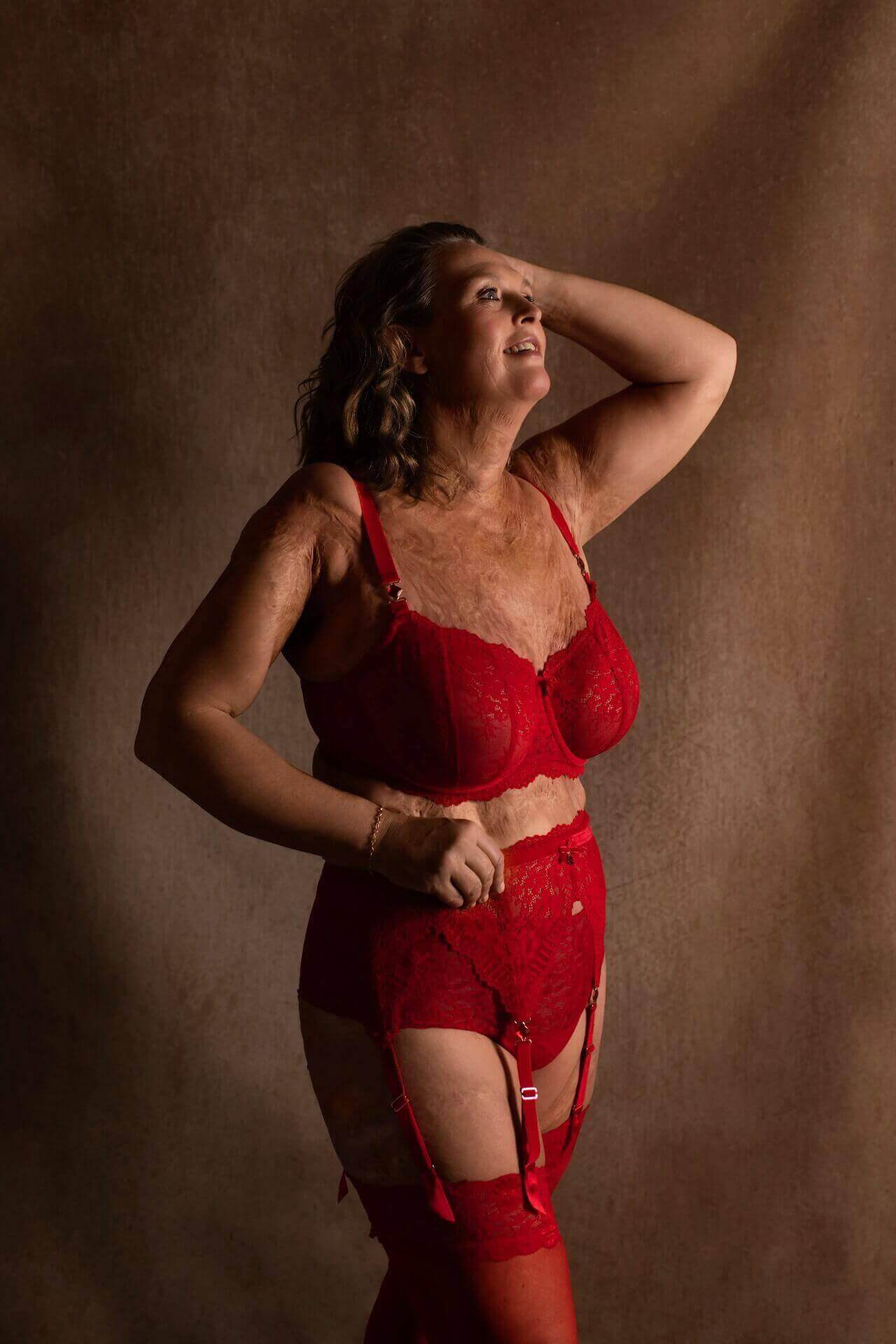 Boudoirshoot met littekens