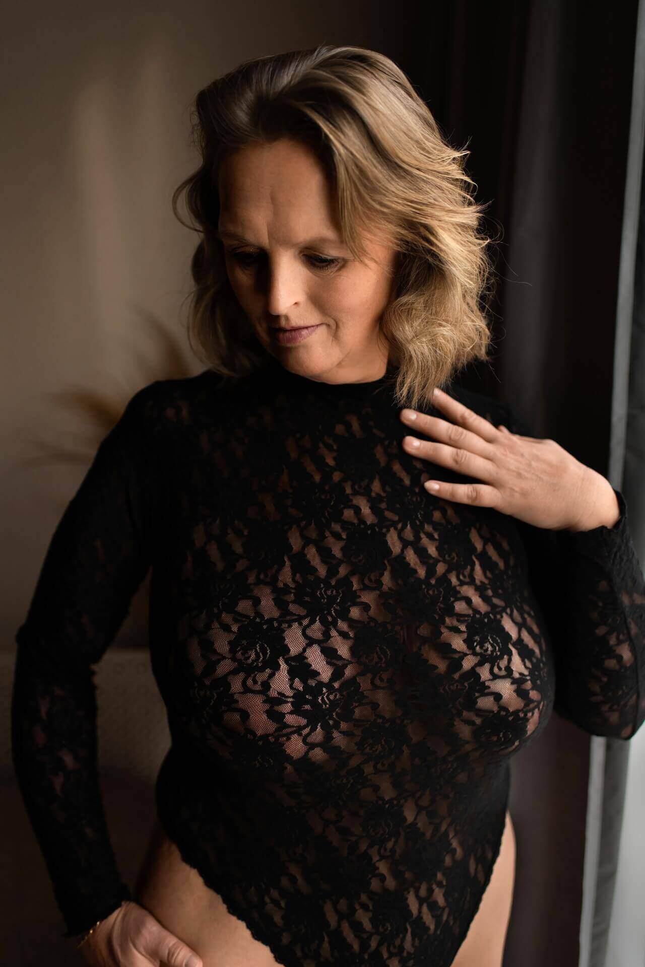 Boudoirfotoshoot met brandwonden